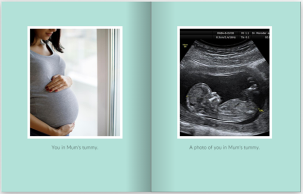 Show details for European Sperm Bank | English | Mum 